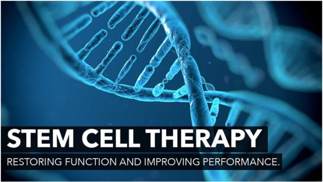 The Affirmatives of Stem Cell Therapy